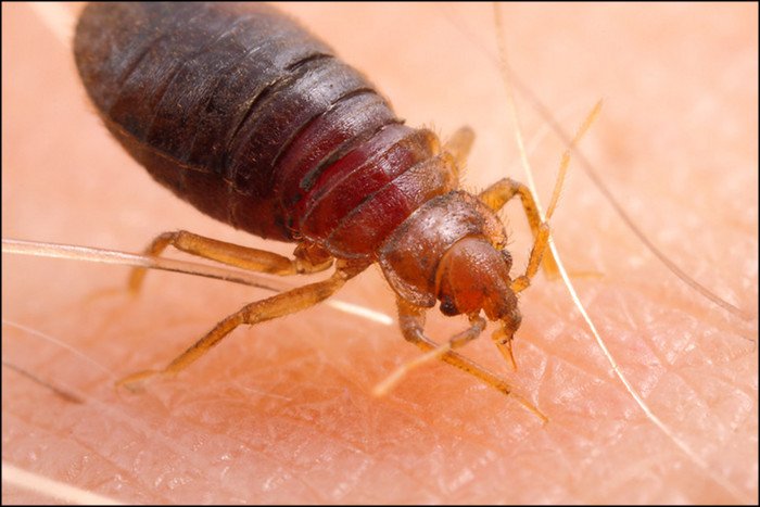 bed bug magnified